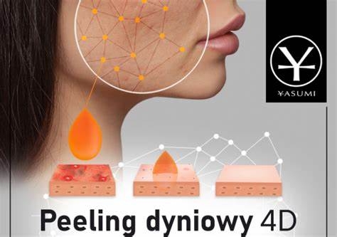 Peeling dyniowy 4D