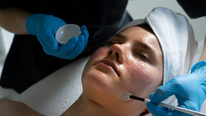 Peeling chemiczny z kwasem migdałowym - terapia wygładzająca dla różnych typów skóry